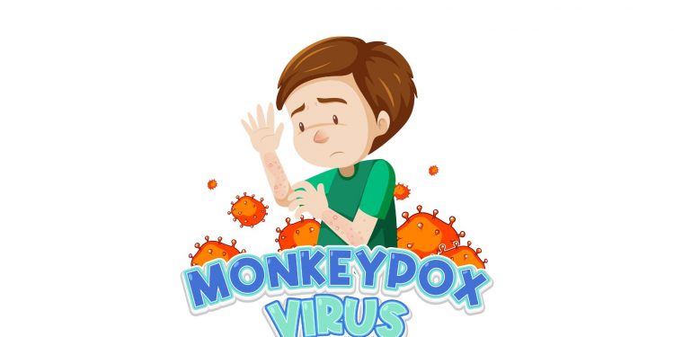 Kabar Baik! Kasus Cacar Monyet Melandai di Indonesia