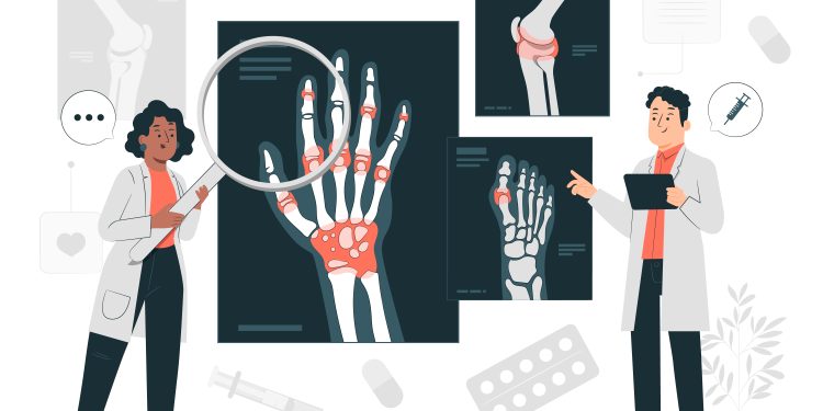 Dilema Ketenagakerjaan Penyandang Autoimun