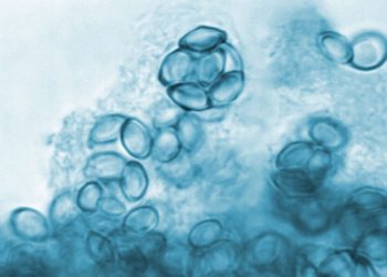 Mengenal Jamur, Penyakit Kulit yang Banyak Faktor Pemicunya