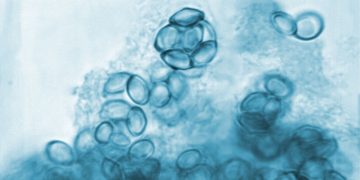 Mengenal Jamur, Penyakit Kulit yang Banyak Faktor Pemicunya