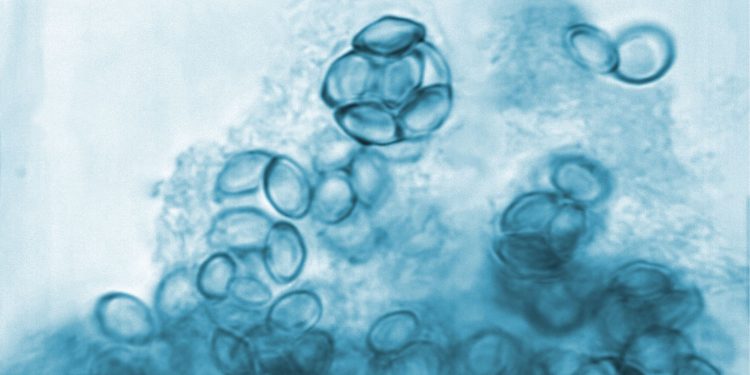 Mengenal Jamur, Penyakit Kulit yang Banyak Faktor Pemicunya