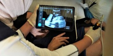 Menuju PHC, CISDI Luncurkan Dua Riset Kesehatan Primer