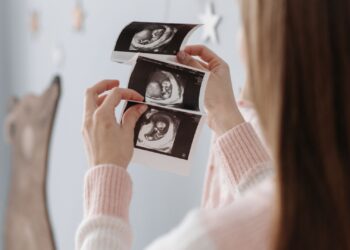 Kesenjangan Gender Pengaruhi Prevalensi AKI dan AKB