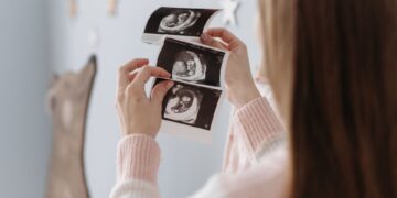 Kesenjangan Gender Pengaruhi Prevalensi AKI dan AKB