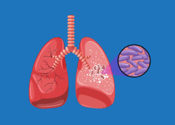Eliminasi TBC Terganjal Anggaran?