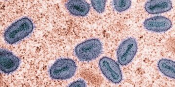 WHO-Kemenkes, Pantau Patogen Berpotensi Pandemi