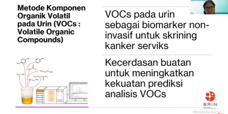 KANKER SERVIKS: Inovasi Skrining Berbasis AI Tingkatkan Akurasi Deteksi Dini
