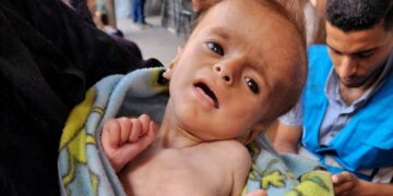 Kelaparan di Gaza, WHO Kecam Tindakan Pemiskinan