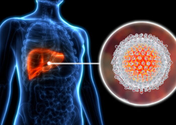 Perangi Hepatitis Perlu Lebih Banyak Tindakan untuk Mencapai Target