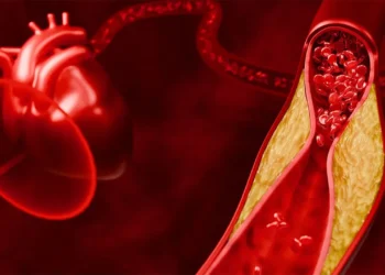Penyebab dan Faktor Risiko Dislipidemia, Berhentilah Merokok